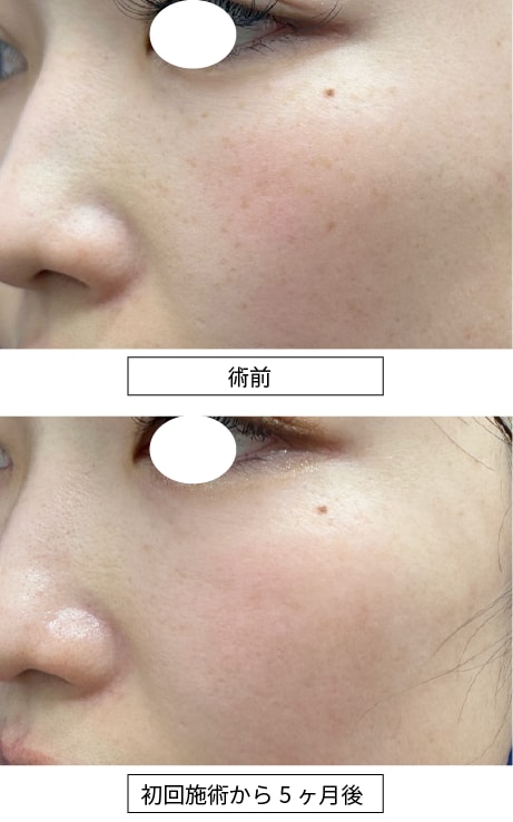 ※撮影環境も完全に揃えています