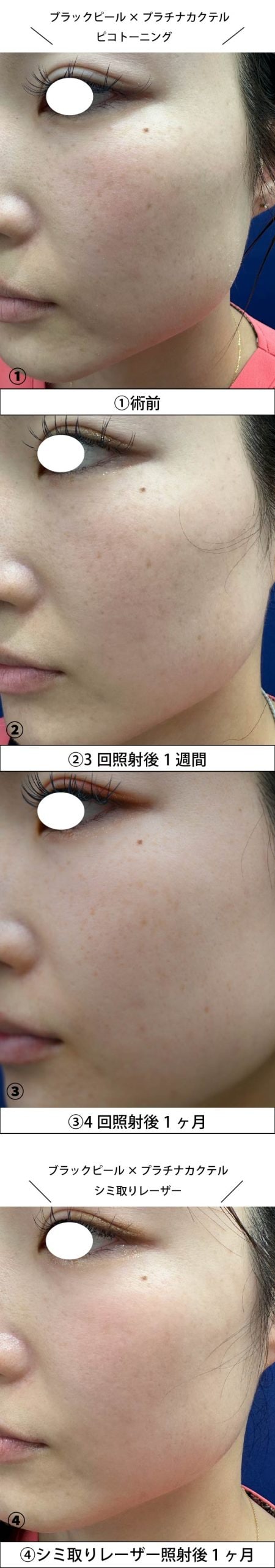 長期経過をご紹介