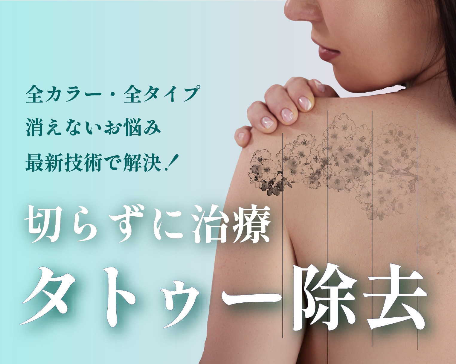 福山【タトゥー/刺青除去】ピコレーザーで切らずにタトゥー除去｜湘南美容クリニック福山院