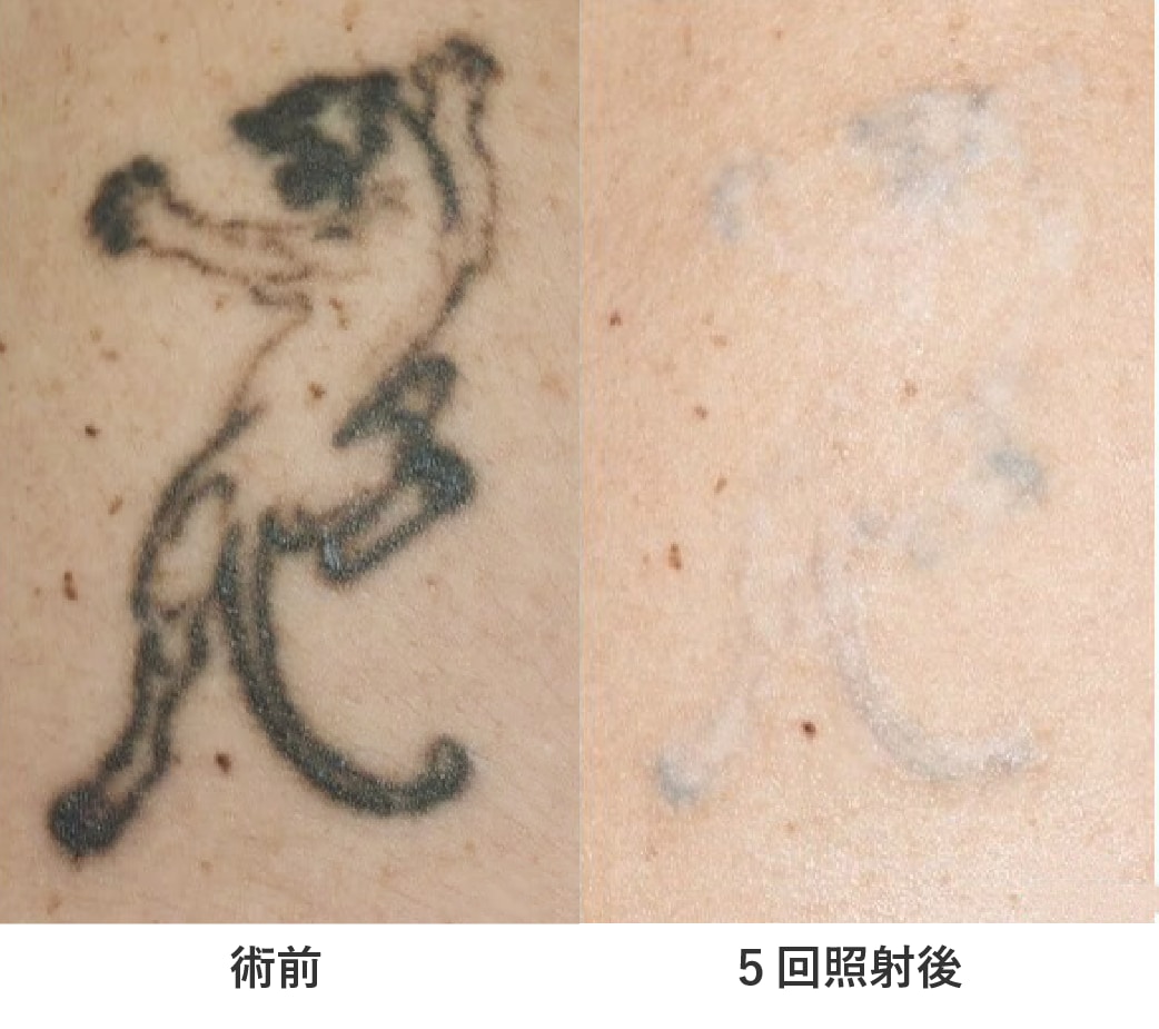 実際に施術を受けた方の症例を紹介