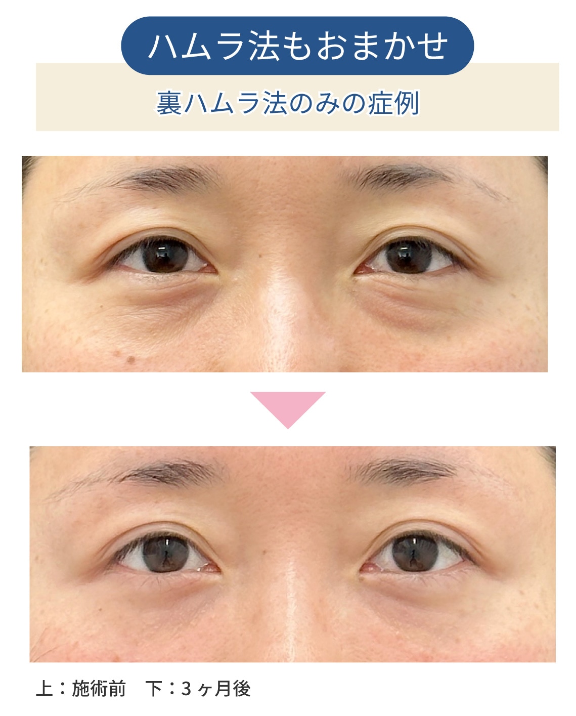 30代の症例解説