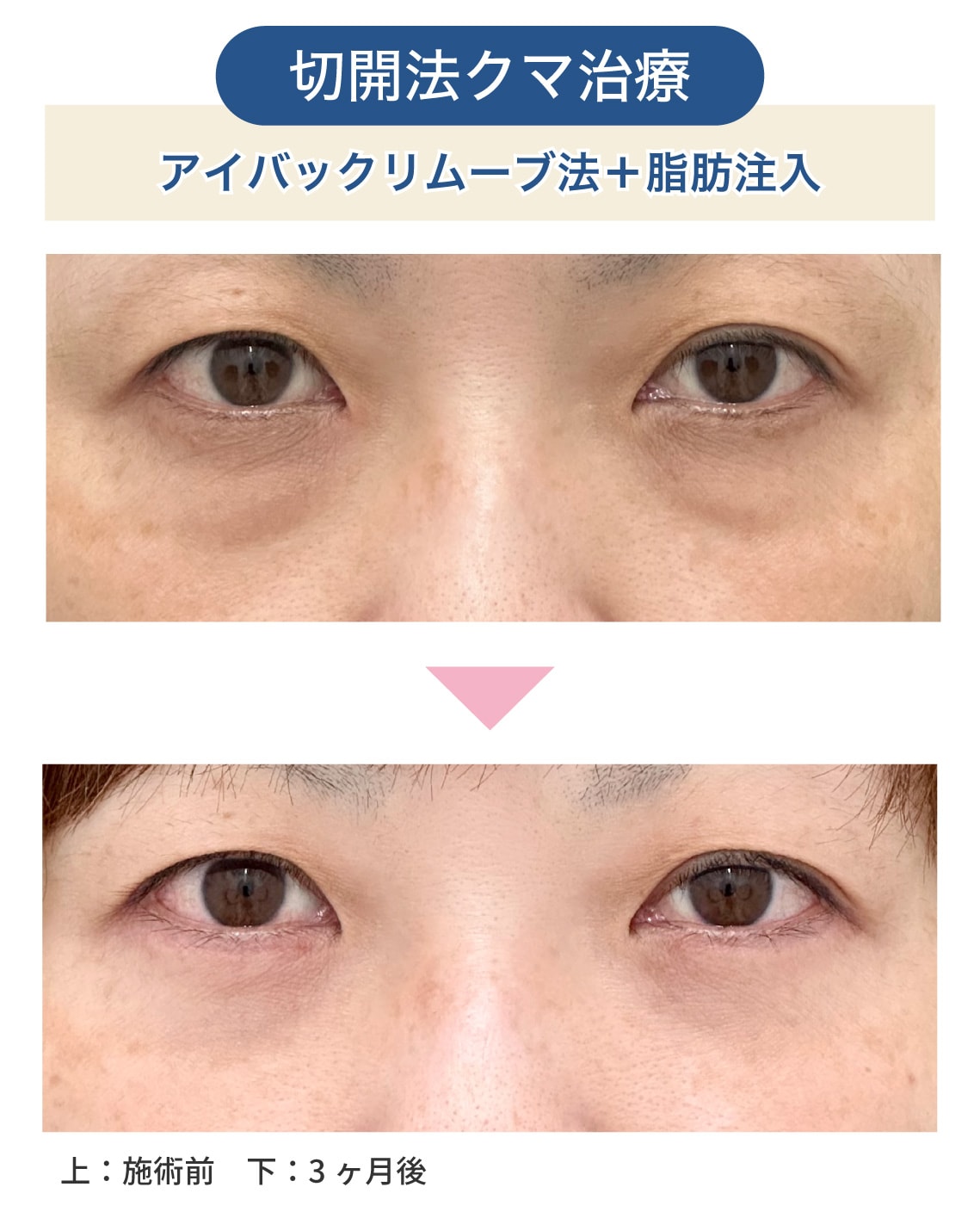 40代の症例解説