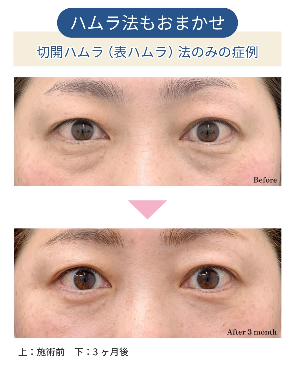 40代女性の症例解説