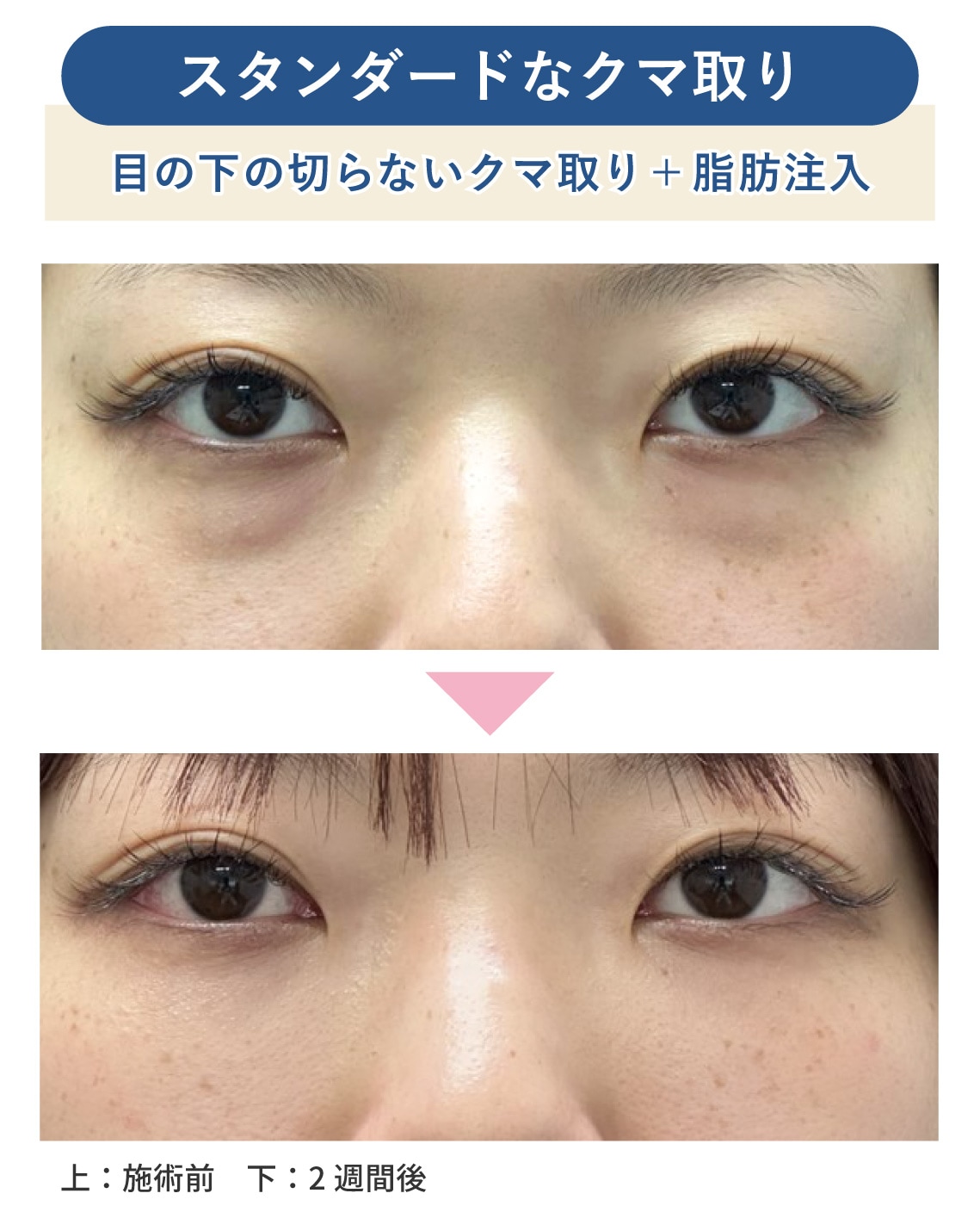 20代の症例解説