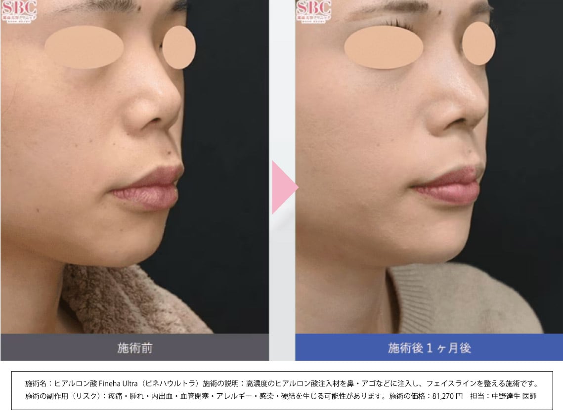 まずは症例写真をご覧ください✨