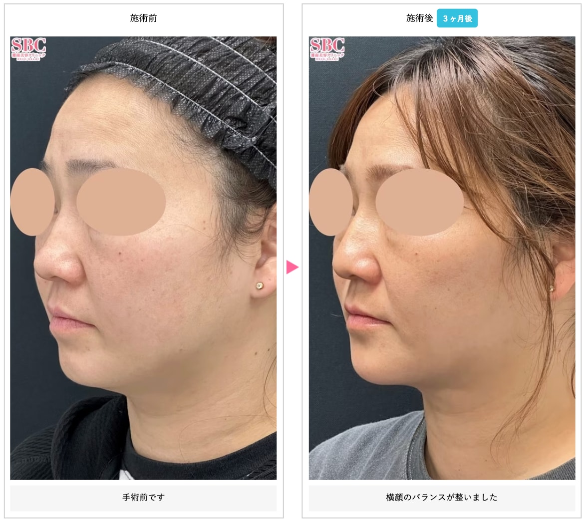 39歳女性《森🌳正徳院長：担当》