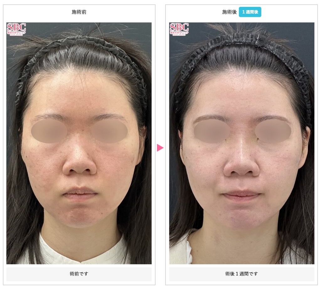 20歳女性《森🌳正徳院長：担当》