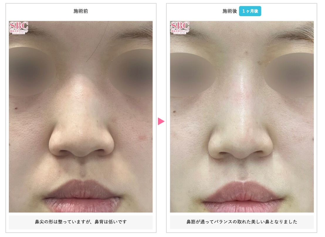 22歳女性《森🌳正徳院長：担当》