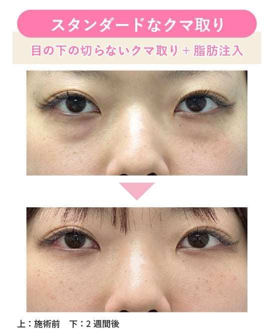 スタンダードなメニュー