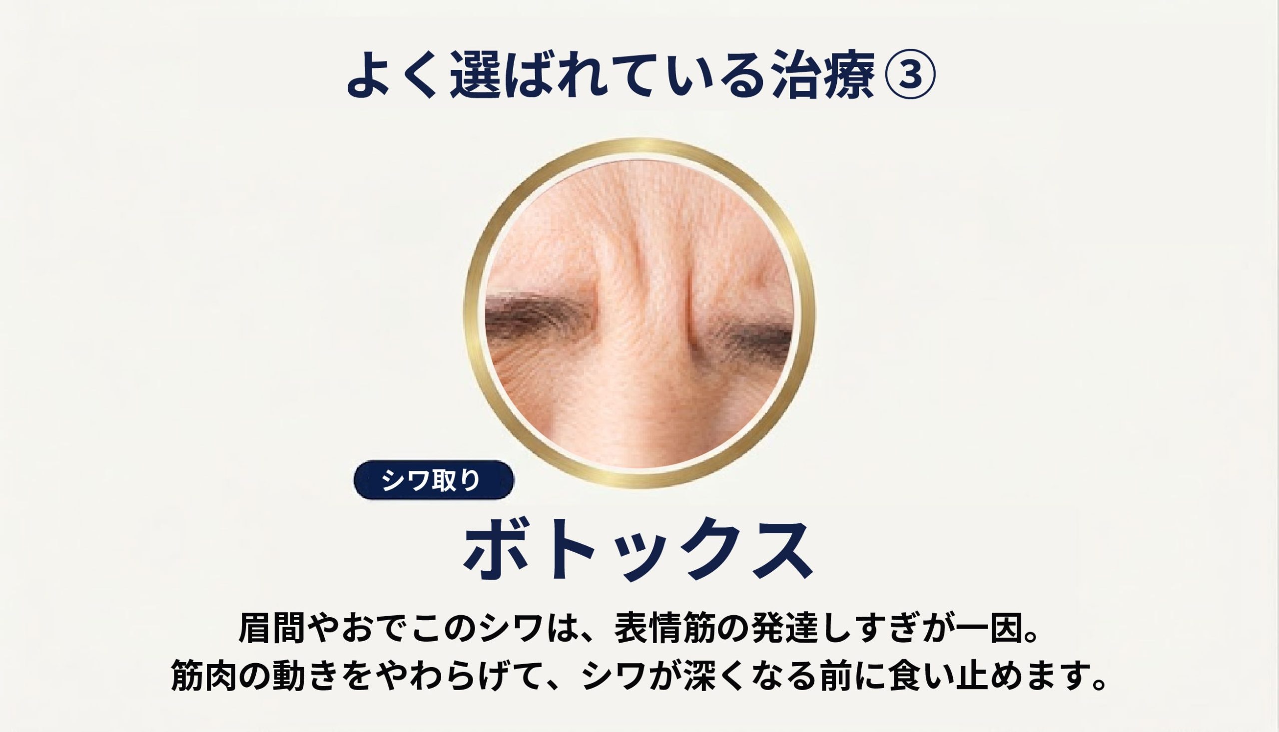表情ジワが気になるなら「しわ取り注射」