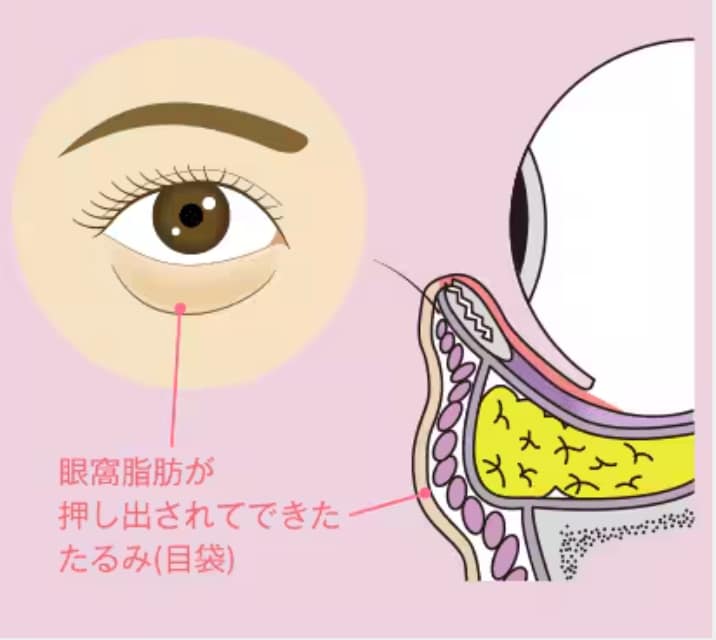 画像の説明