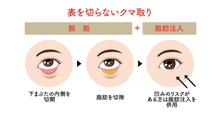 表を切らない方法