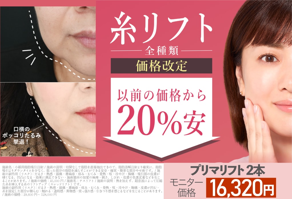 糸リフト20%OFF