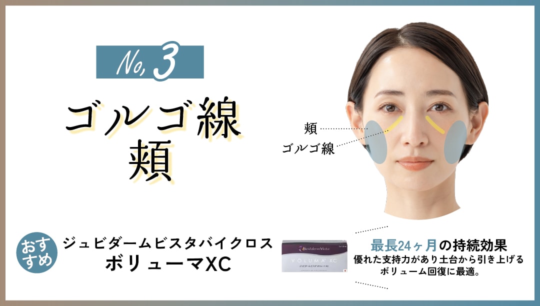 ゴルゴ線・頬