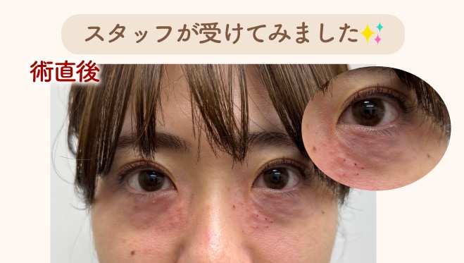 ダウンタイムはこんな感じ