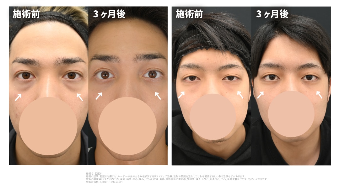 20代