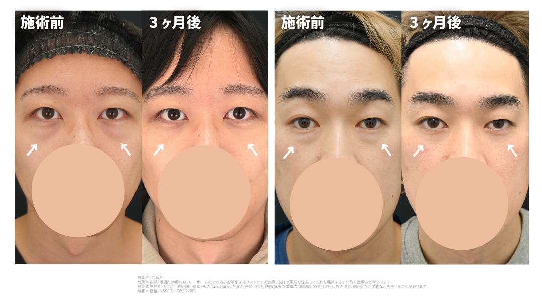 30代