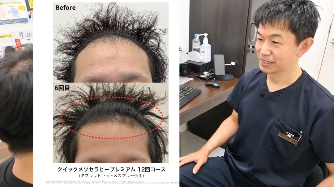 大野院長がAGAのリードドクター!