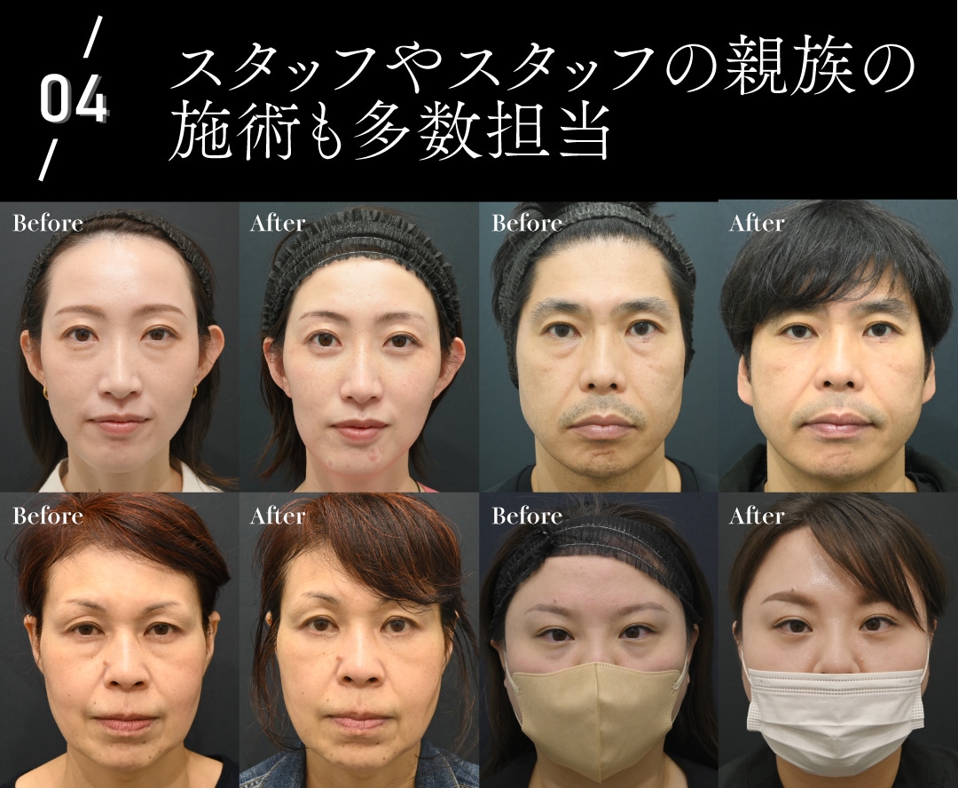 スタッフやスタッフの親族の施術も多数担当