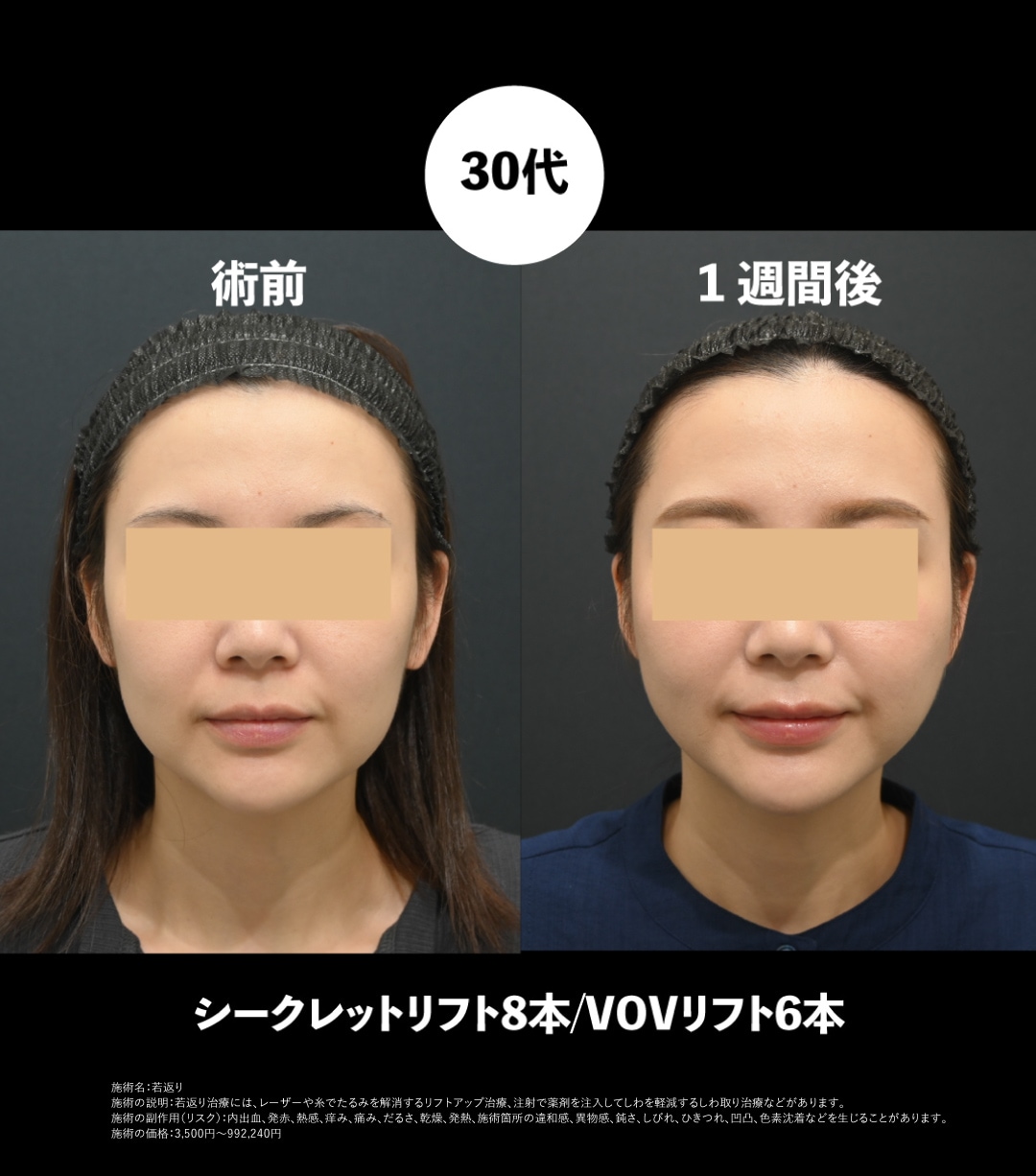 30代