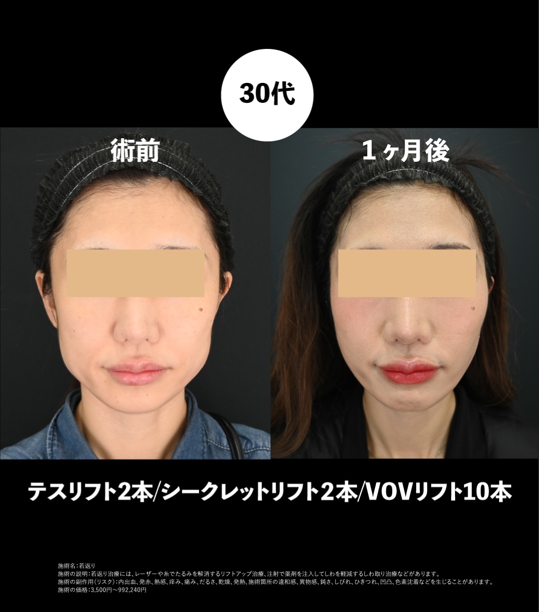 30代