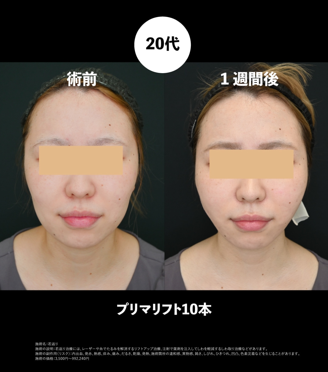 20代