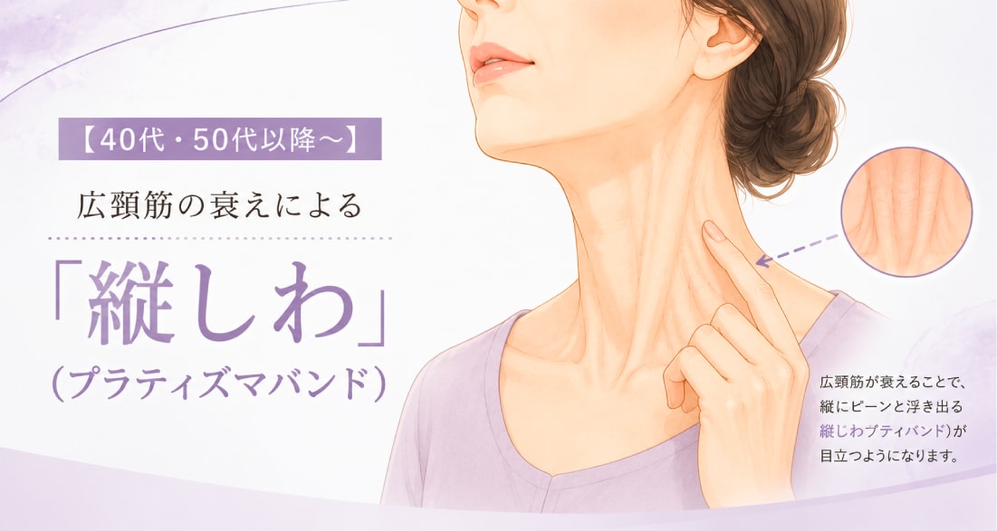 【40代・50代以降〜】広頸筋の衰えによる「縦しわ（プラティズマバンド）」