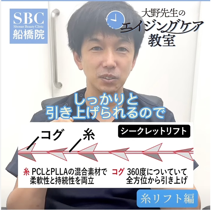 シークレットリフトについて