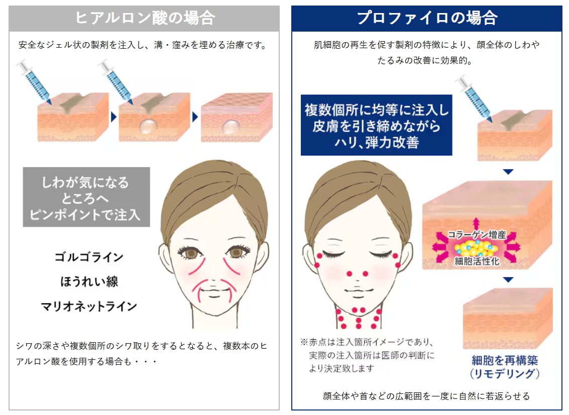 従来のヒアルロン酸との違い