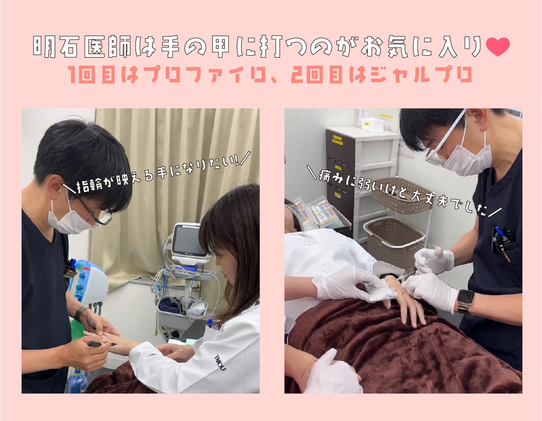 痛みに弱い明石純奈医師も先日「手のシワ取り」受けました！