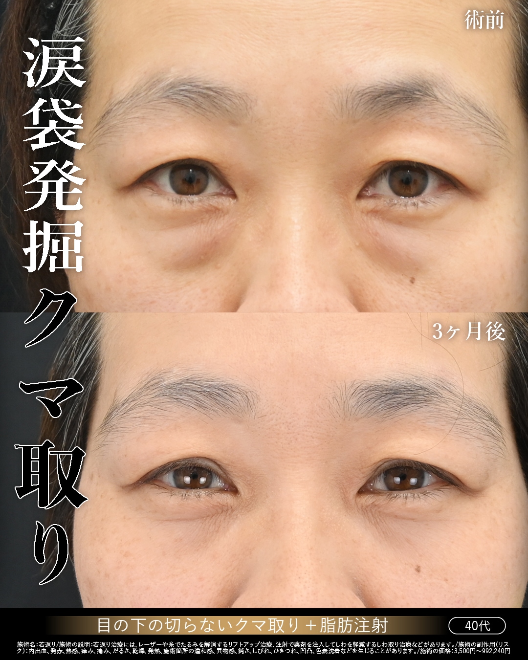 40代