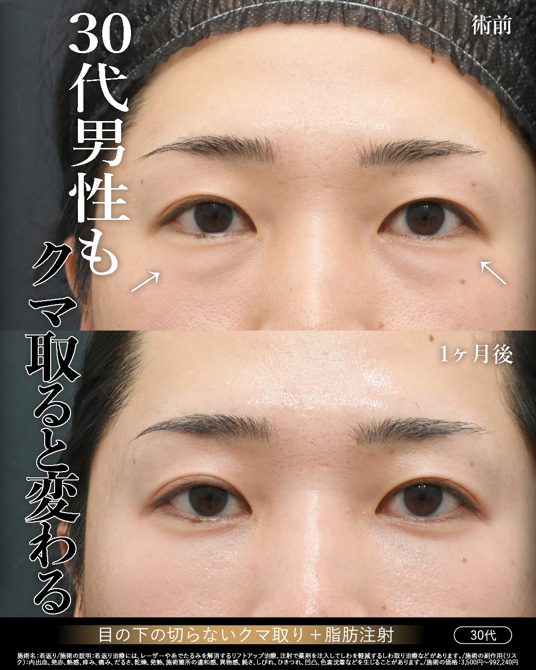 30代