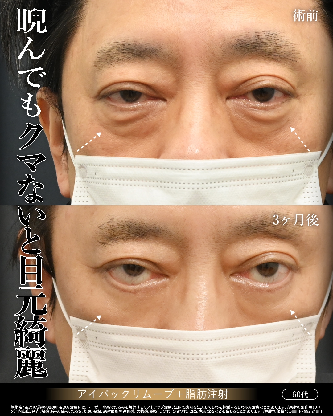 60代