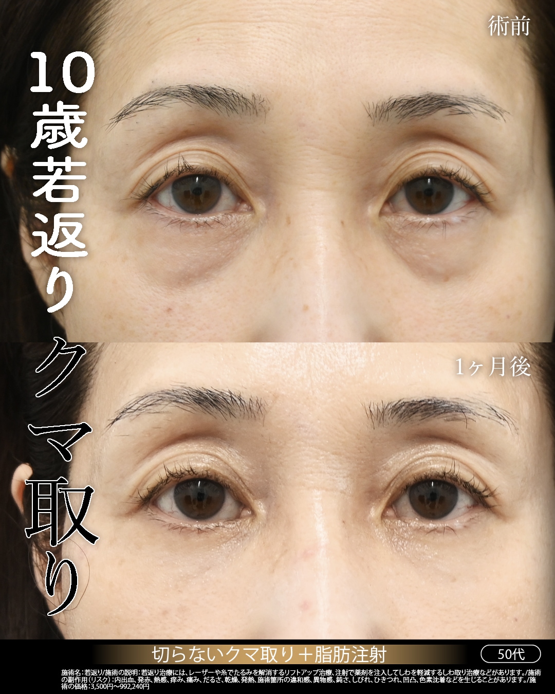 50代