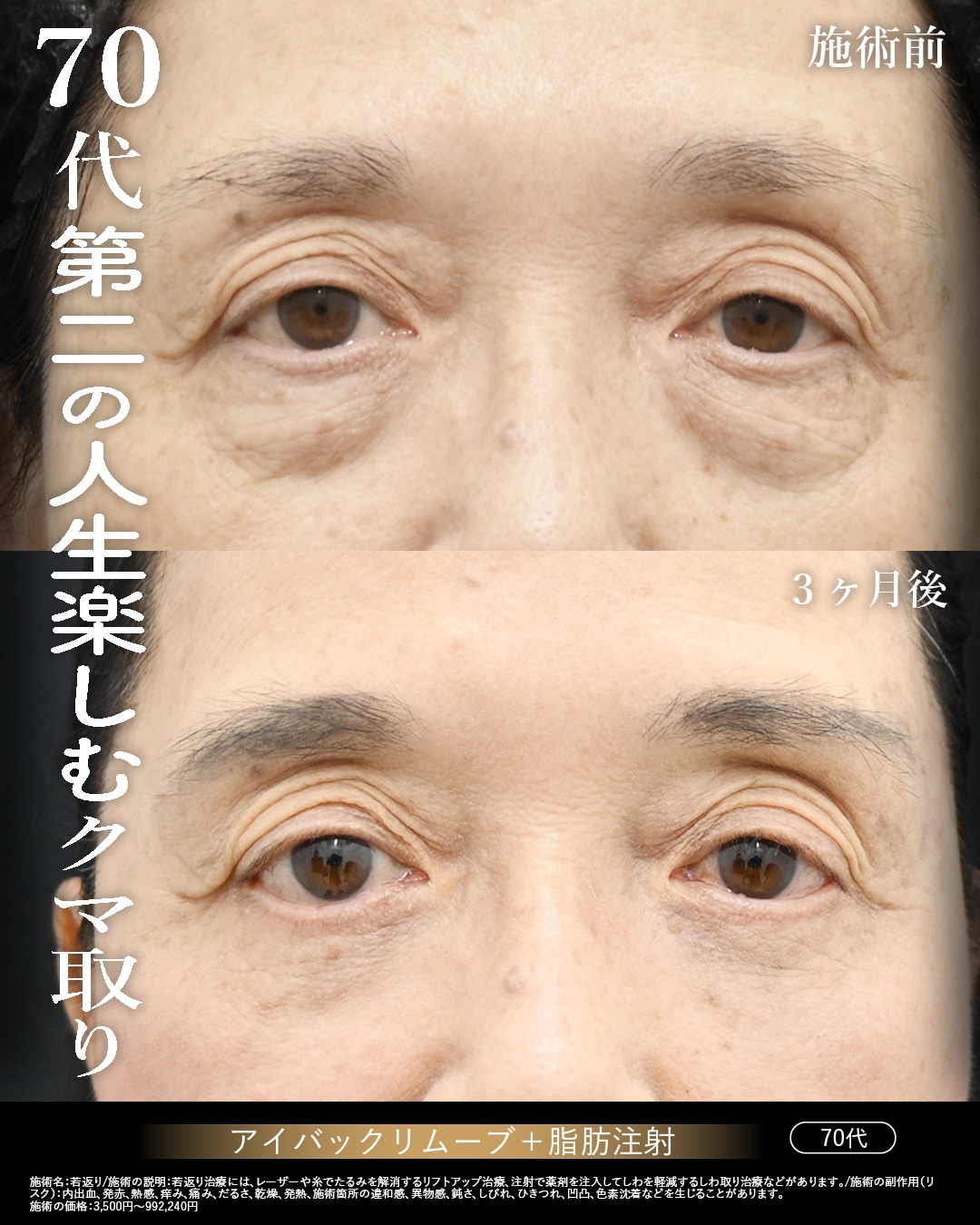 70代