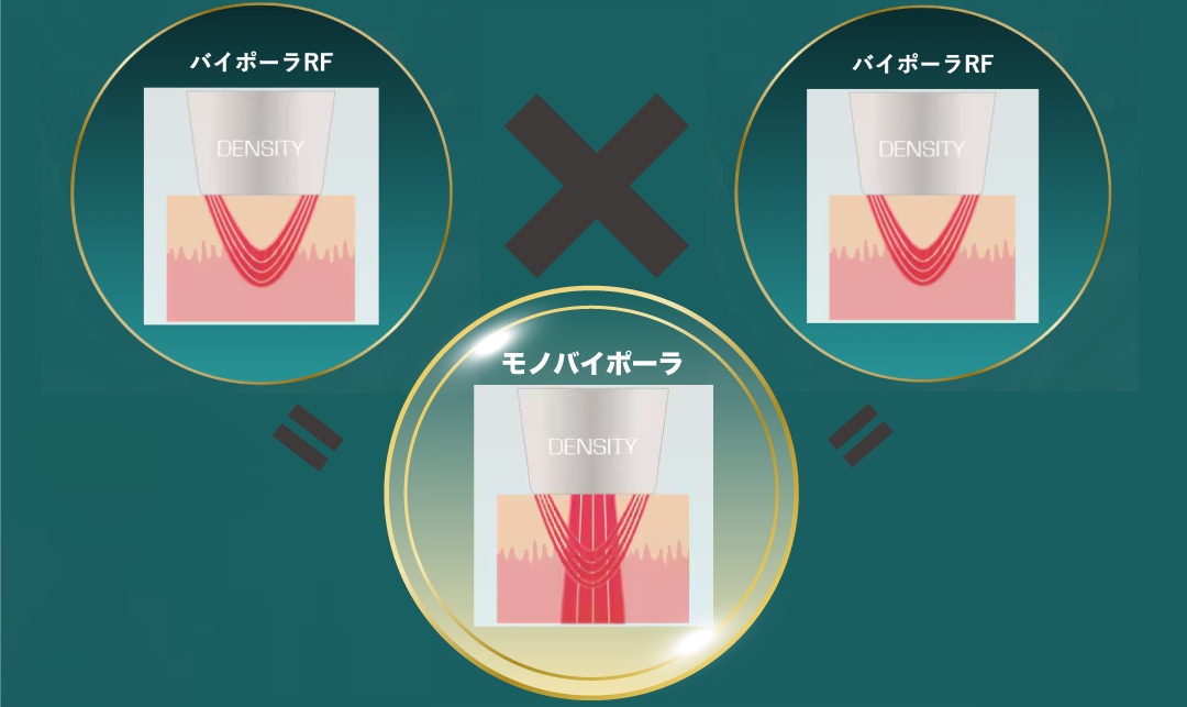 “即時×持続”を両立した次世代たるみ治療
