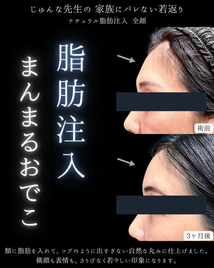 症例