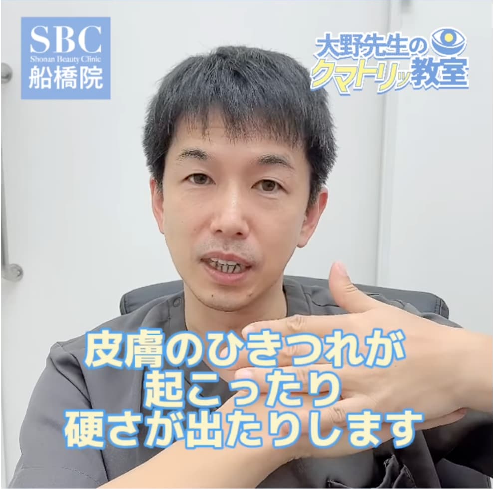 脂肪を吸った部分を皮膚が埋めようとして起こる引き攣れです。