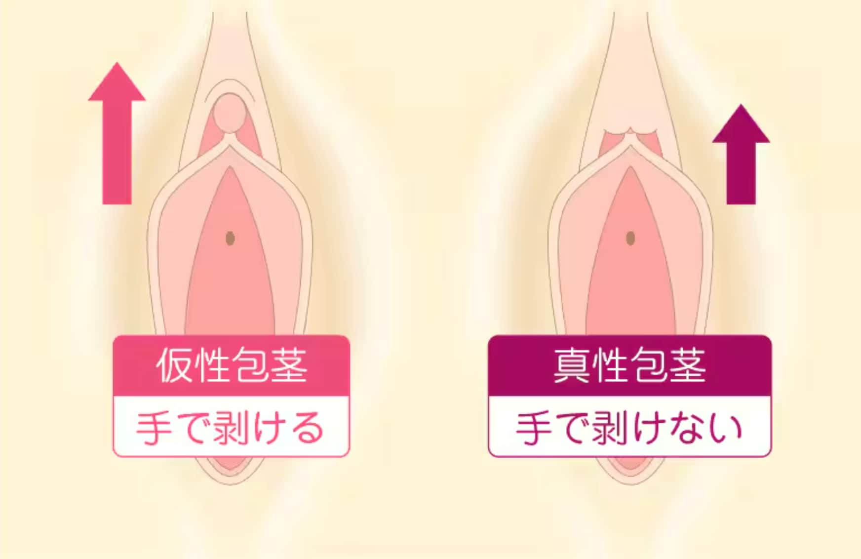 かんたんセルフチェック