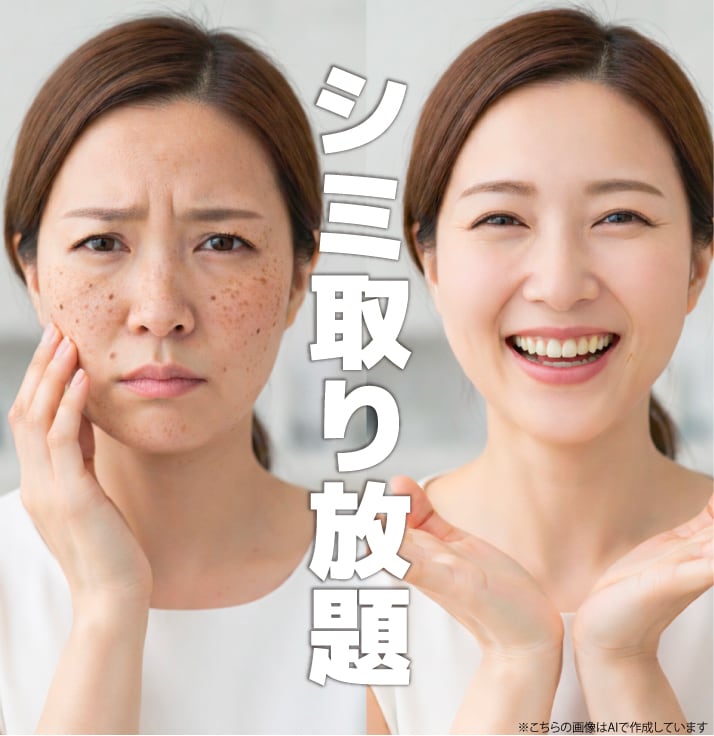 【2026年最新】船橋でシミ取りなら湘南美容クリニック｜おすすめのレーザー治療と取り放題プラン（10個）を徹底解説