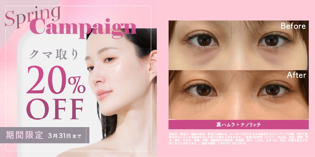 クマ取りキャンペーン | 湘南美容クリニック船橋院