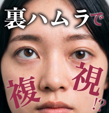 裏ハムラ法で複視（二重に見える）になる？リスクと原因、失敗しない外科医選びをベテラン医師が解説 | SBC船橋院