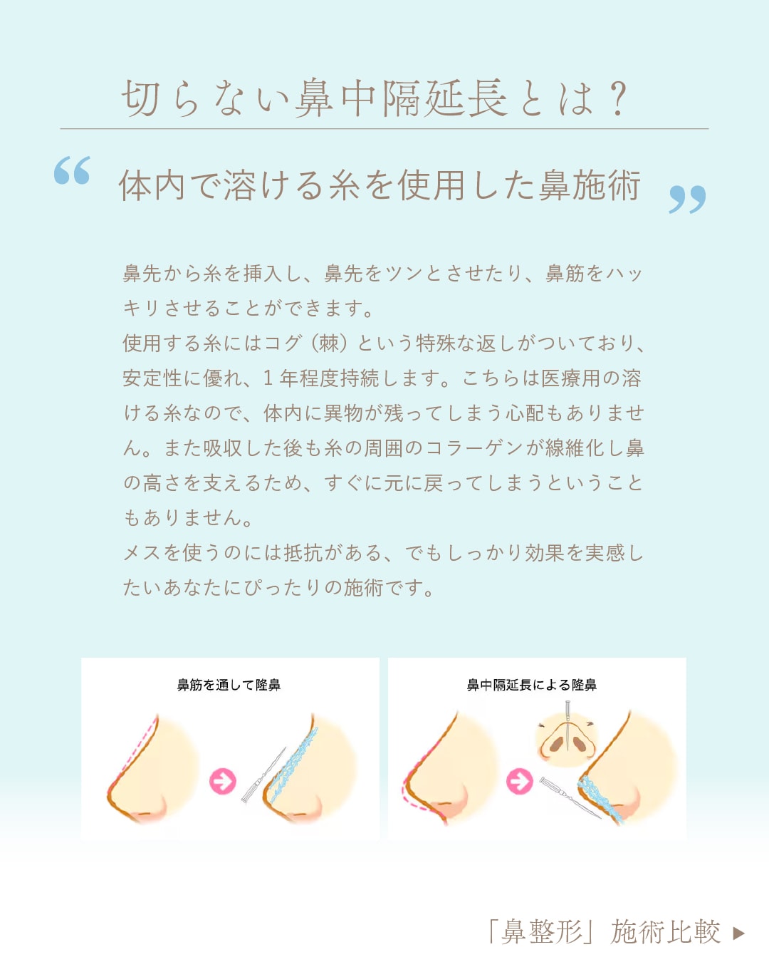 テスリフトノーズ詳細2