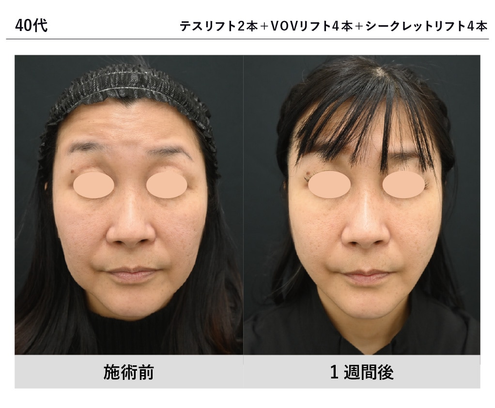 大野医師症例写真