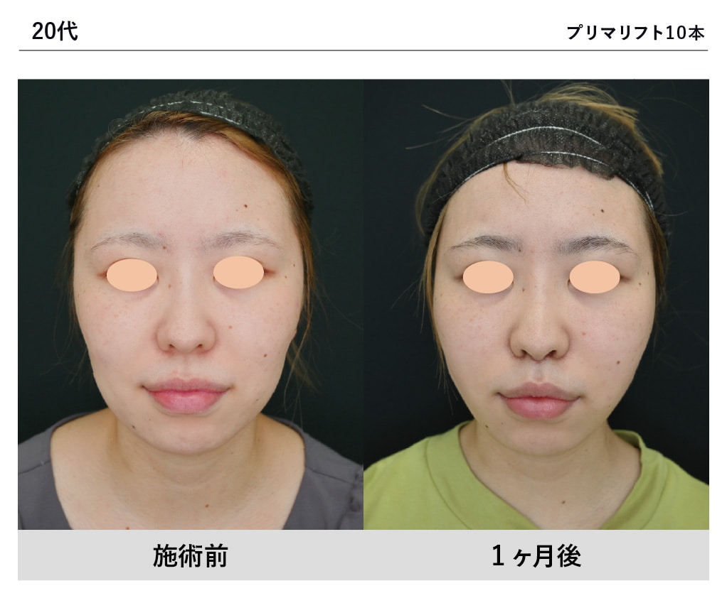 大野医師症例写真
