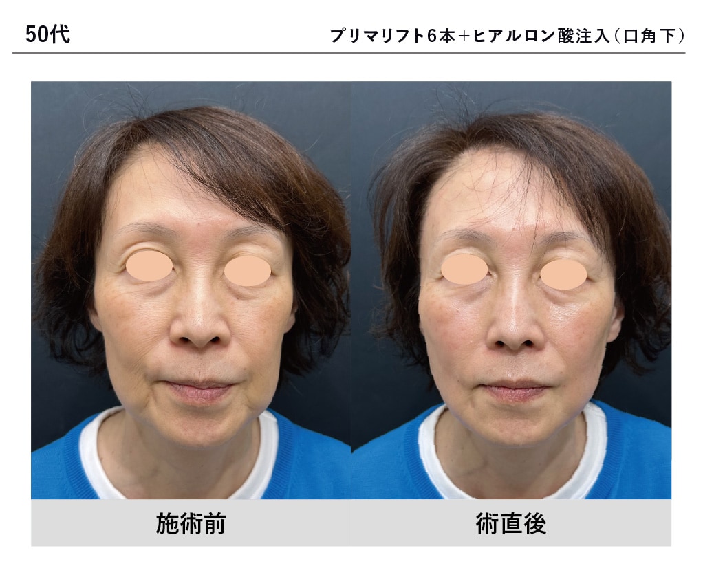 明石医師症例写真