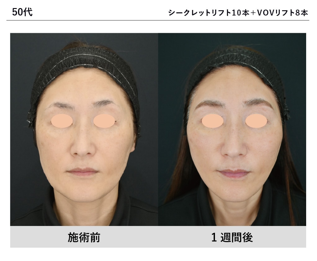 柳川医師症例写真