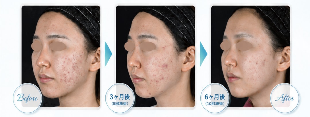 最強ステップで手に入る３つの変化