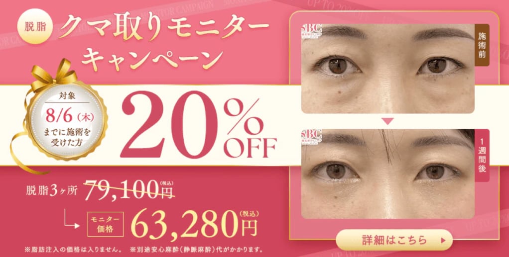 クマ取り20%OFF | 湘南美容クリニック船橋院