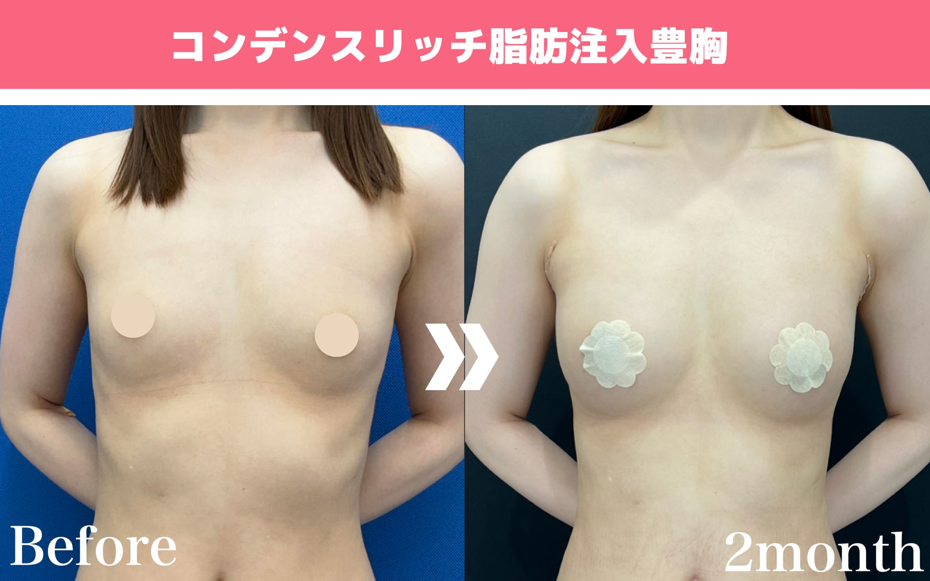 執刀医：柳川雅美医師